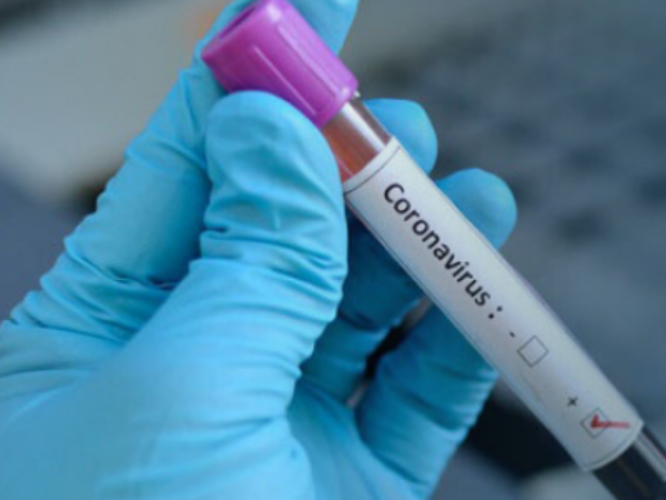 Recursos de Fondos Concursables del Gobierno Regionales serán traspasados para mitigar efectos por coronavirus Recursos de Fondos Concursables del Gobierno Regionales serán traspasados para mitigar efectos por coronavirus